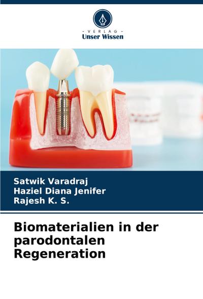 Biomaterialien in der parodontalen Regeneration