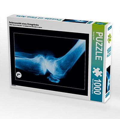 Seitenansicht eines Kniegelenks (Puzzle)