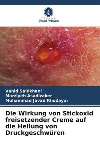 Die Wirkung von Stickoxid freisetzender Creme auf die Heilung von Druckgeschwüren