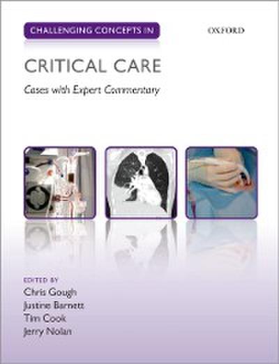 Challenging Concepts in Critical Care