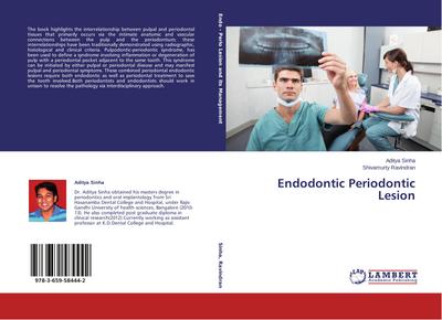 Endodontic Periodontic Lesion