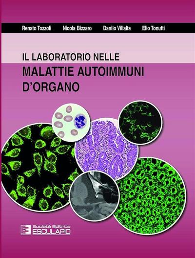 Il laboratorio nelle malattie autoimmuni d’organo