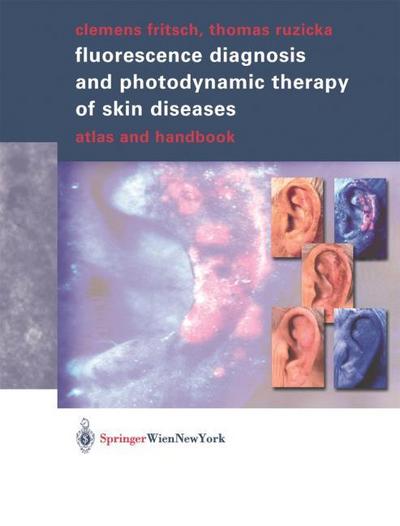 Fluorescence Diagnosis and Photodynamic Therapy of Skin Diseases