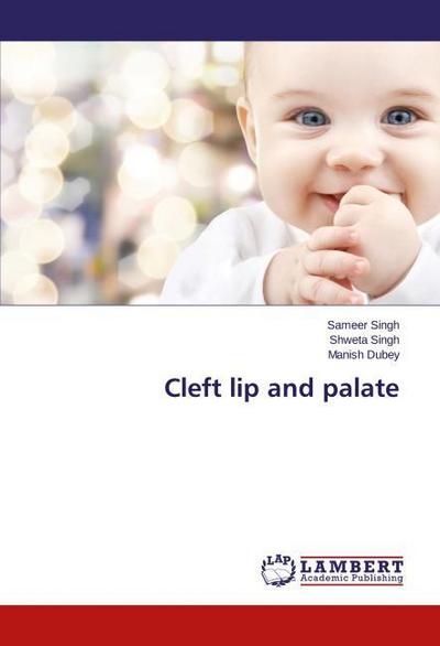 Cleft lip and palate