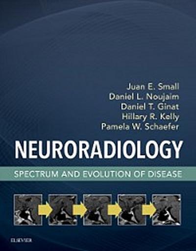 Neuroradiology