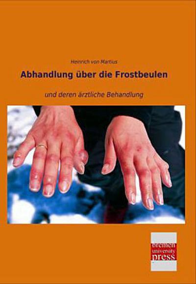 Abhandlung über die Frostbeulen