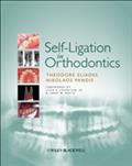 Self-Ligation in Orthodontics