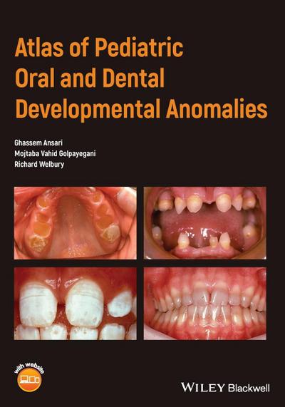 Atlas of Pediatric Oral and Dental Developmental Anomalies