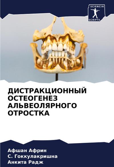 DISTRAKCIONNYJ OSTEOGENEZ AL’VEOLYaRNOGO OTROSTKA