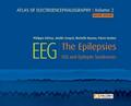 Atlas of electroencephalography Volume 2 : The Epilepsies. 2ED