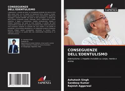 CONSEGUENZE DELL’EDENTULISMO