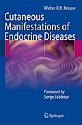 Cutaneous Manifestations of Endocrine Diseases