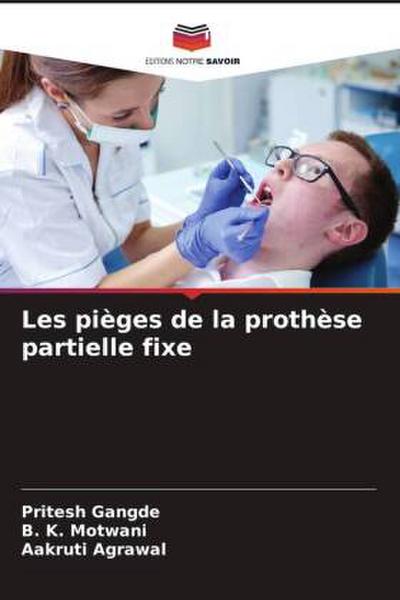 Les pièges de la prothèse partielle fixe