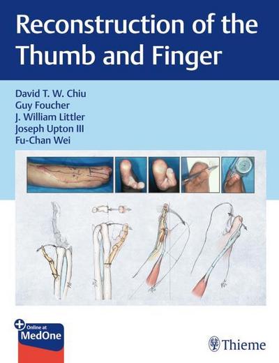 Reconstruction of the Thumb and Finger