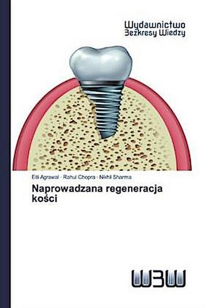 Naprowadzana regeneracja ko¿ci