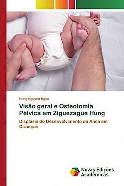 Visão geral e Osteotomia Pélvica em Ziguezague Hung