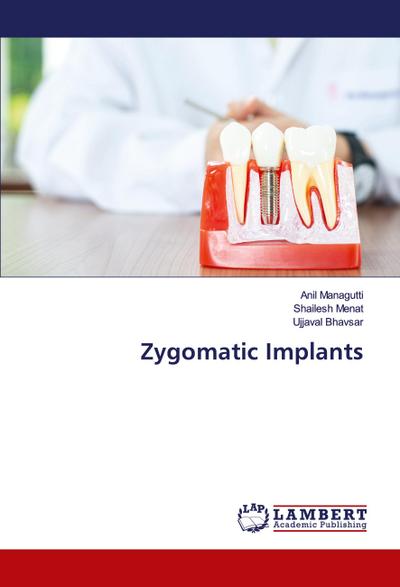 Zygomatic Implants