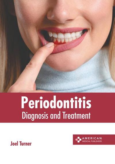 Periodontitis: Diagnosis and Treatment