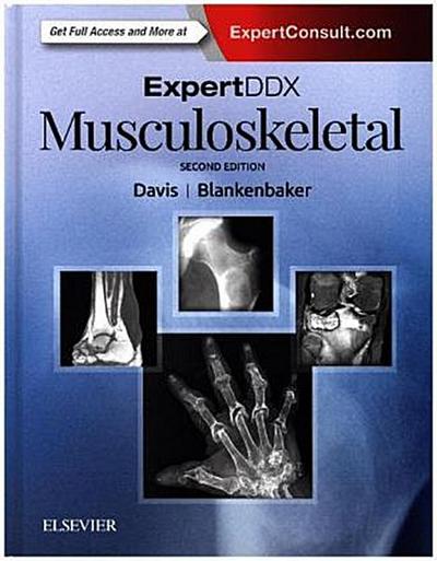 Expertddx: Musculoskeletal