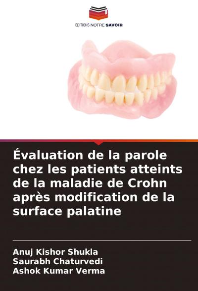 Évaluation de la parole chez les patients atteints de la maladie de Crohn après modification de la surface palatine