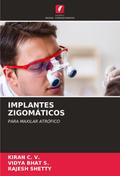 IMPLANTES ZIGOMÁTICOS