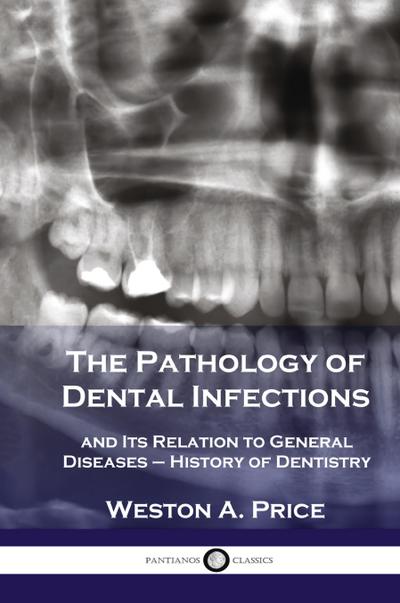 Pathology of Dental Infections