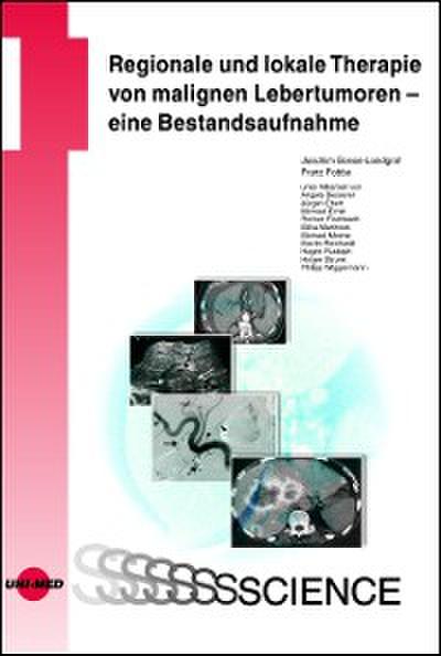 Regionale und lokale Therapie von malignen Lebertumoren - eine Bestandsaufnahme