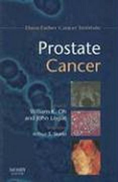 Prostate Cancer (Dana-Farber Cancer Institute Handbook)