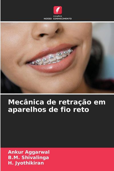 Mecânica de retração em aparelhos de fio reto