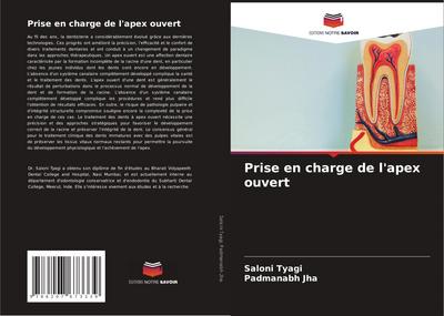 Prise en charge de l’apex ouvert