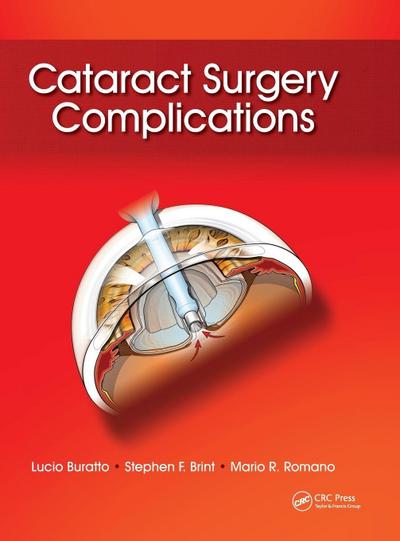 Cataract Surgery Complications