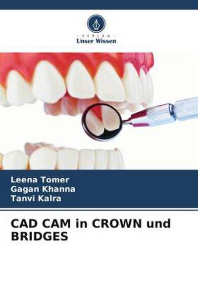 CAD CAM in CROWN und BRIDGES
