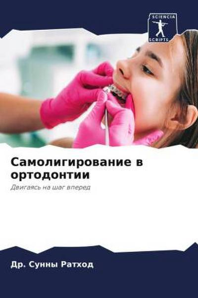 Samoligirowanie w ortodontii