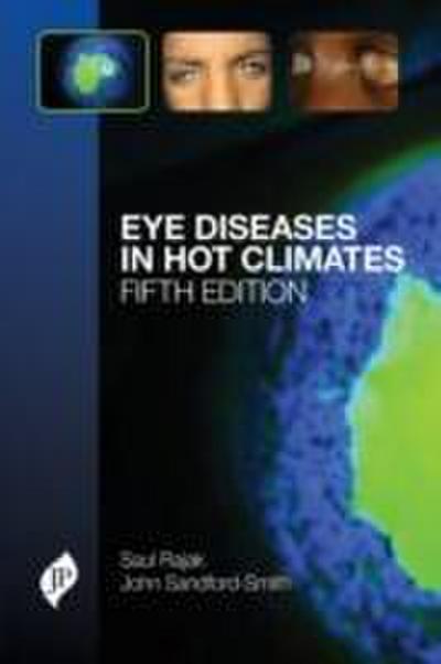 Sandford-Smith, J: Eye Diseases in Hot Climates