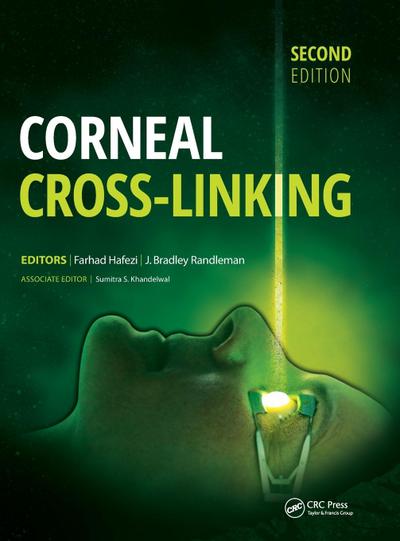 Corneal Cross-Linking