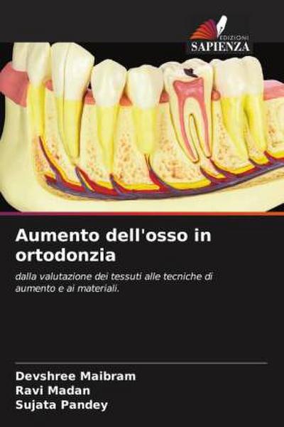 Aumento dell’osso in ortodonzia