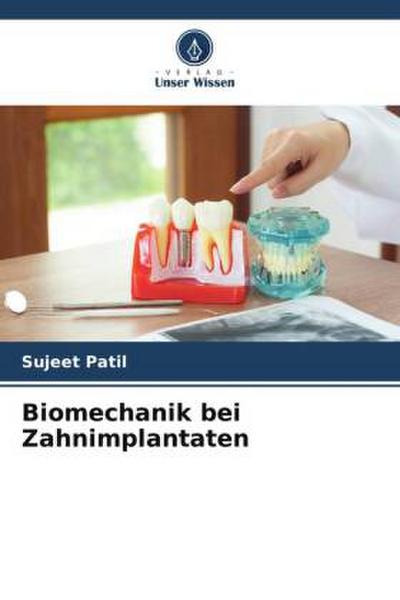 Biomechanik bei Zahnimplantaten