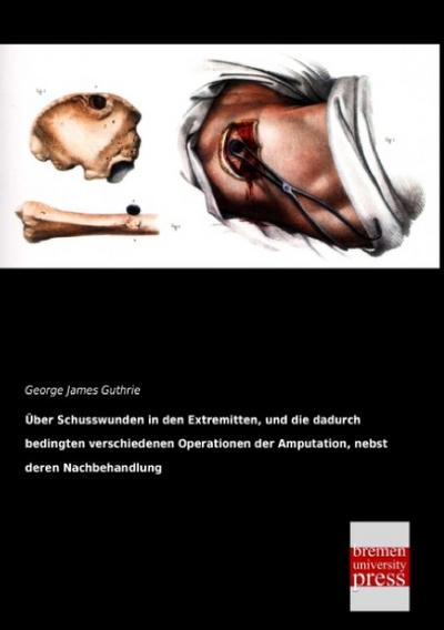 Über Schusswunden in den Extremitten, und die dadurch bedingten verschiedenen Operationen der Amputation, nebst deren Nachbehandlung