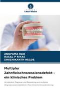Multipler Zahnfleischrezessionsdefekt - ein klinis