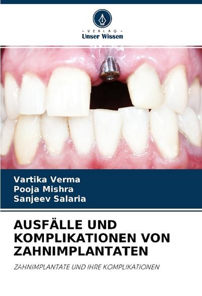 AUSFÄLLE UND KOMPLIKATIONEN VON ZAHNIMPLANTATEN