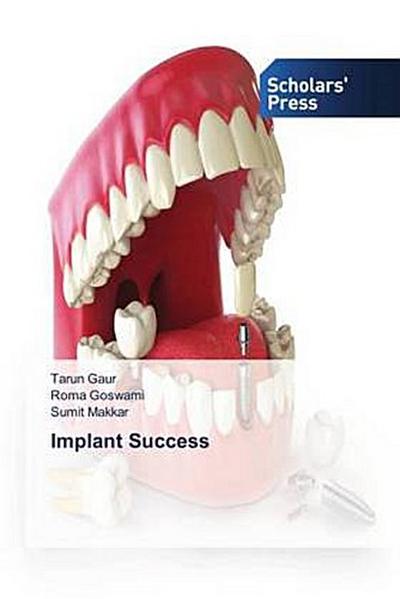 Implant Success