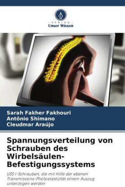 Spannungsverteilung von Schrauben des Wirbelsäulen-Befestigungssystems