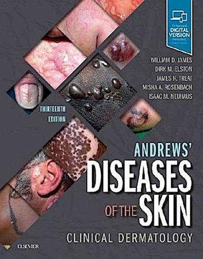 Andrews’ Diseases of the Skin