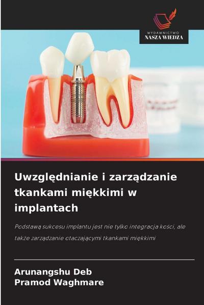 Uwzgl¿dnianie i zarz¿dzanie tkankami mi¿kkimi w implantach