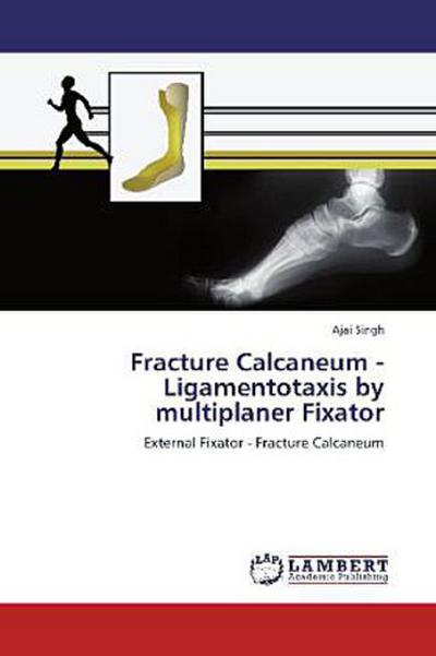 Fracture Calcaneum - Ligamentotaxis by multiplaner Fixator