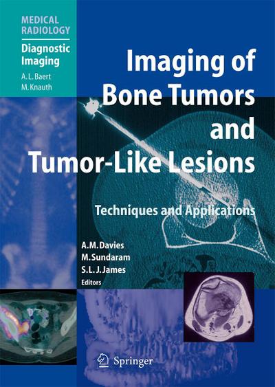Imaging of Bone Tumors and Tumor-Like Lesions