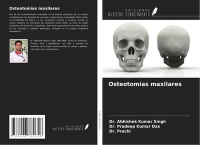 Osteotomías maxilares