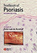 Textbook of Psoriasis