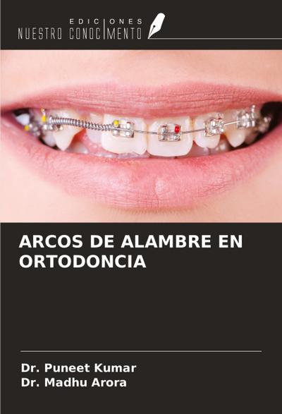 ARCOS DE ALAMBRE EN ORTODONCIA