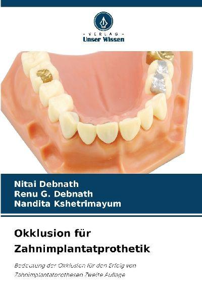 Okklusion für Zahnimplantatprothetik